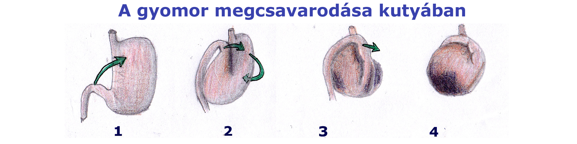 vitapetgyomorcsavar